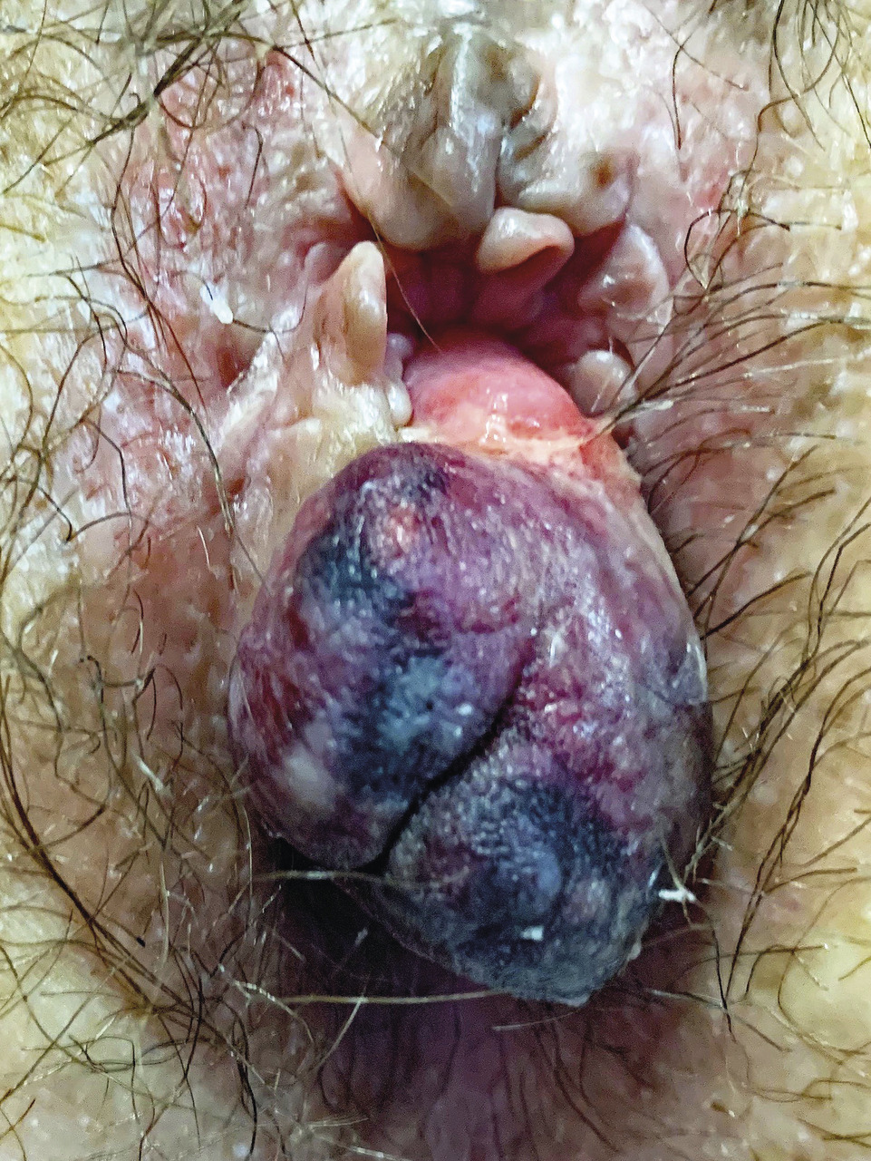 Mars battant de cloche